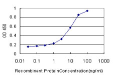 E - PTK7 Antibody (monoclonal) (M02) AT3488a